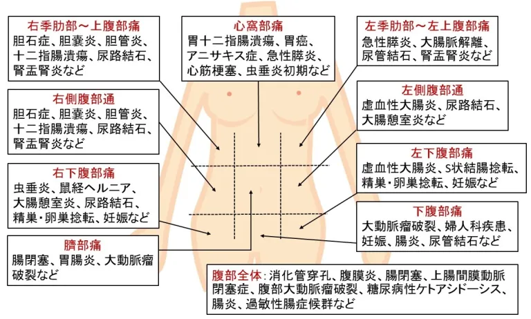 腹痛における部位による分類