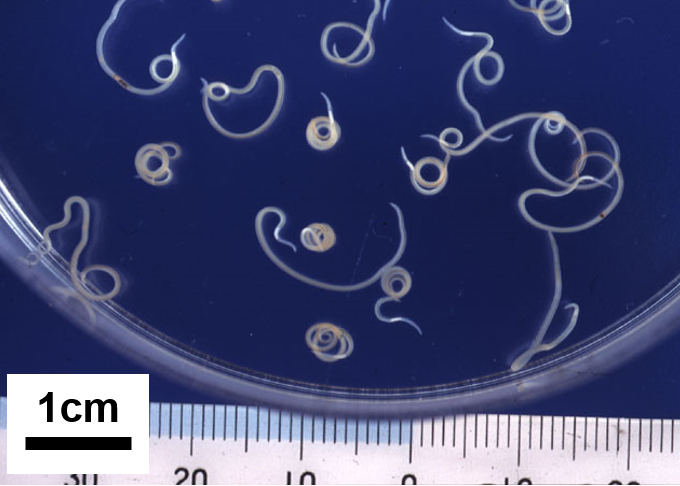 アニサキス症の病原体