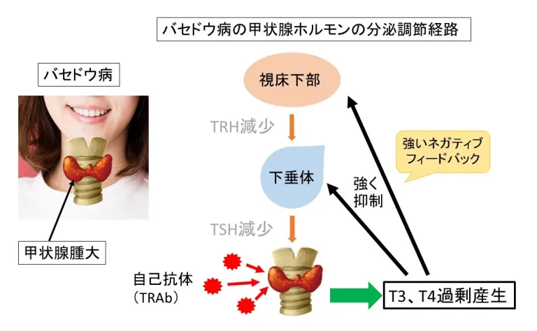 バセドウ病の甲状腺ホルモンの分泌調整経路