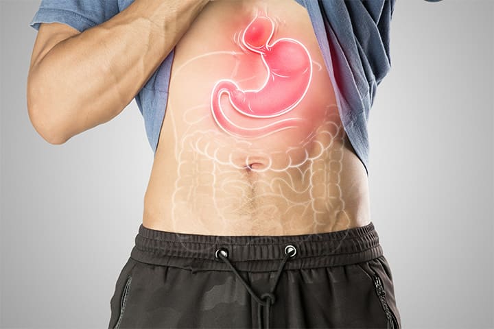 食道裂孔ヘルニア